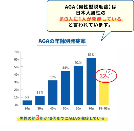 AGAの年齢別発症率